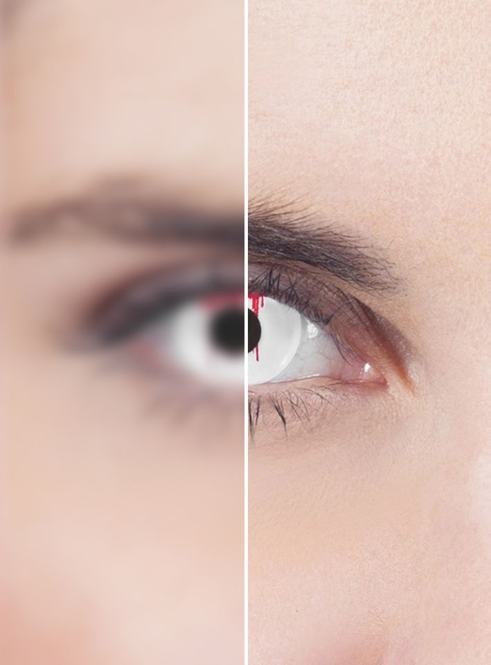 Blutendes Auge weiß Kontaktlinse mit Dioptrien