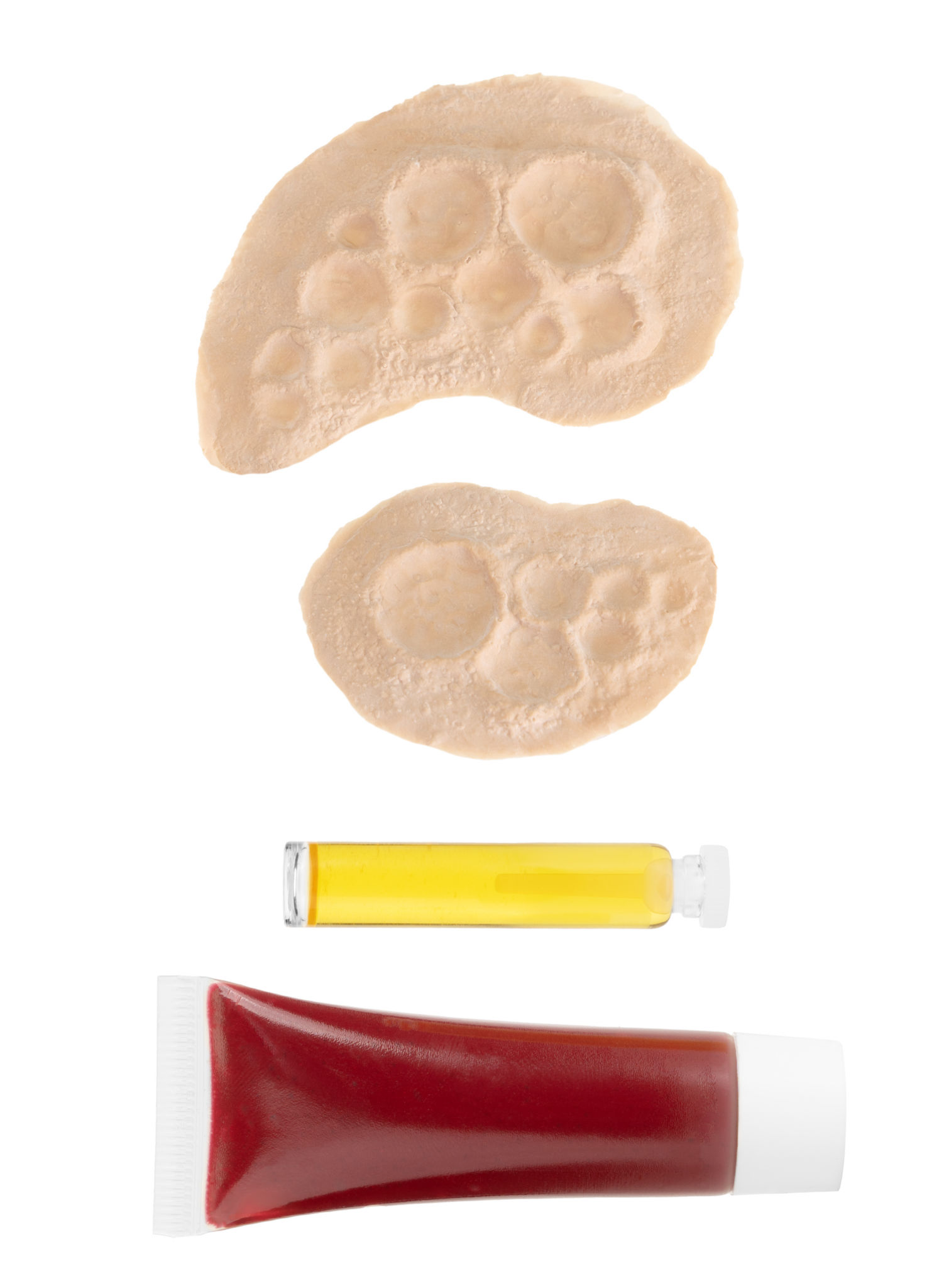 Strahlenbrand Wunden aus Latex